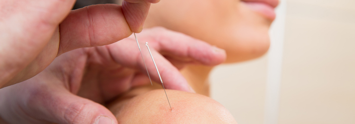 Chiropractic East Brunswick NJ Acupuncture